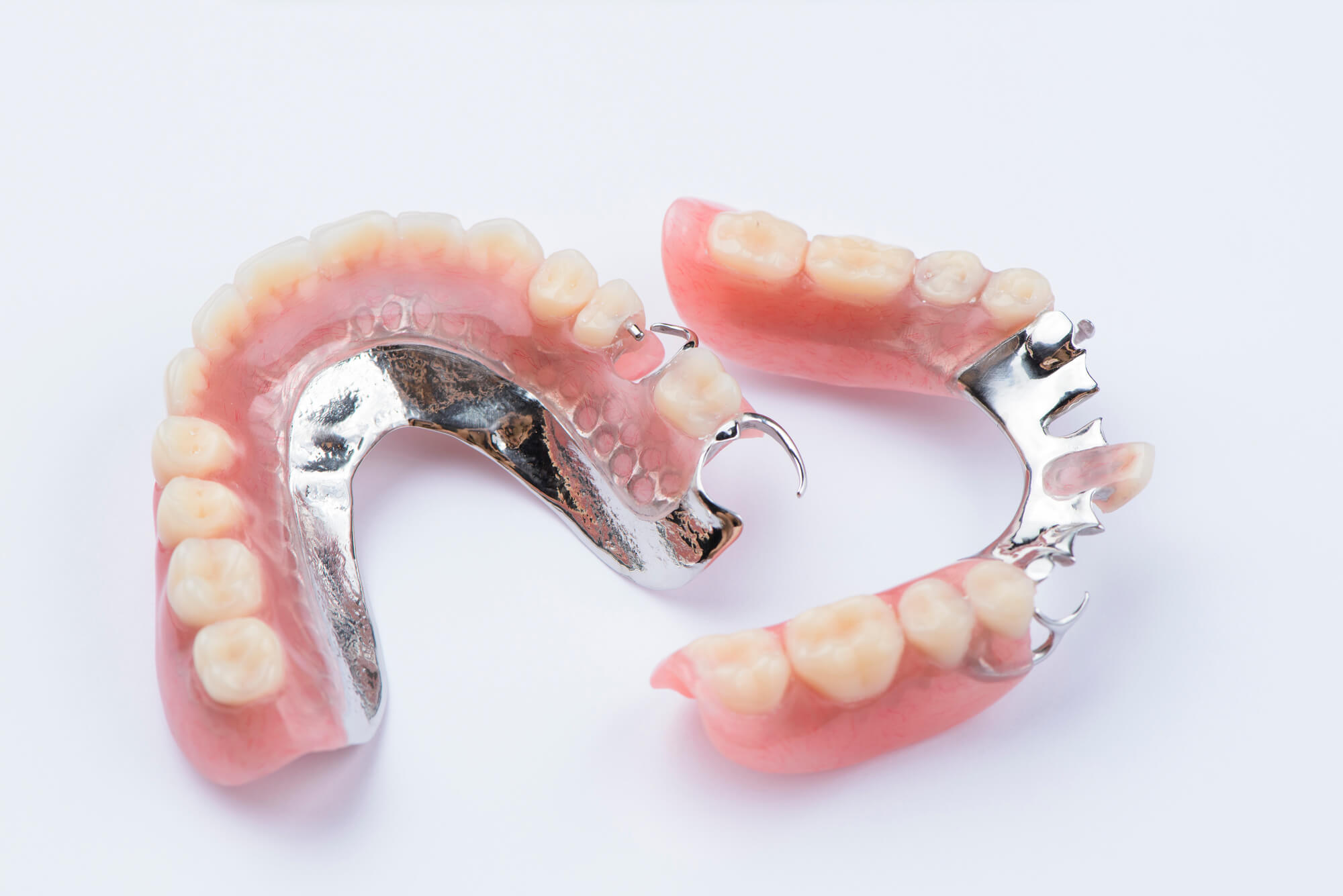 金属のフレームと強化プラスチックの歯