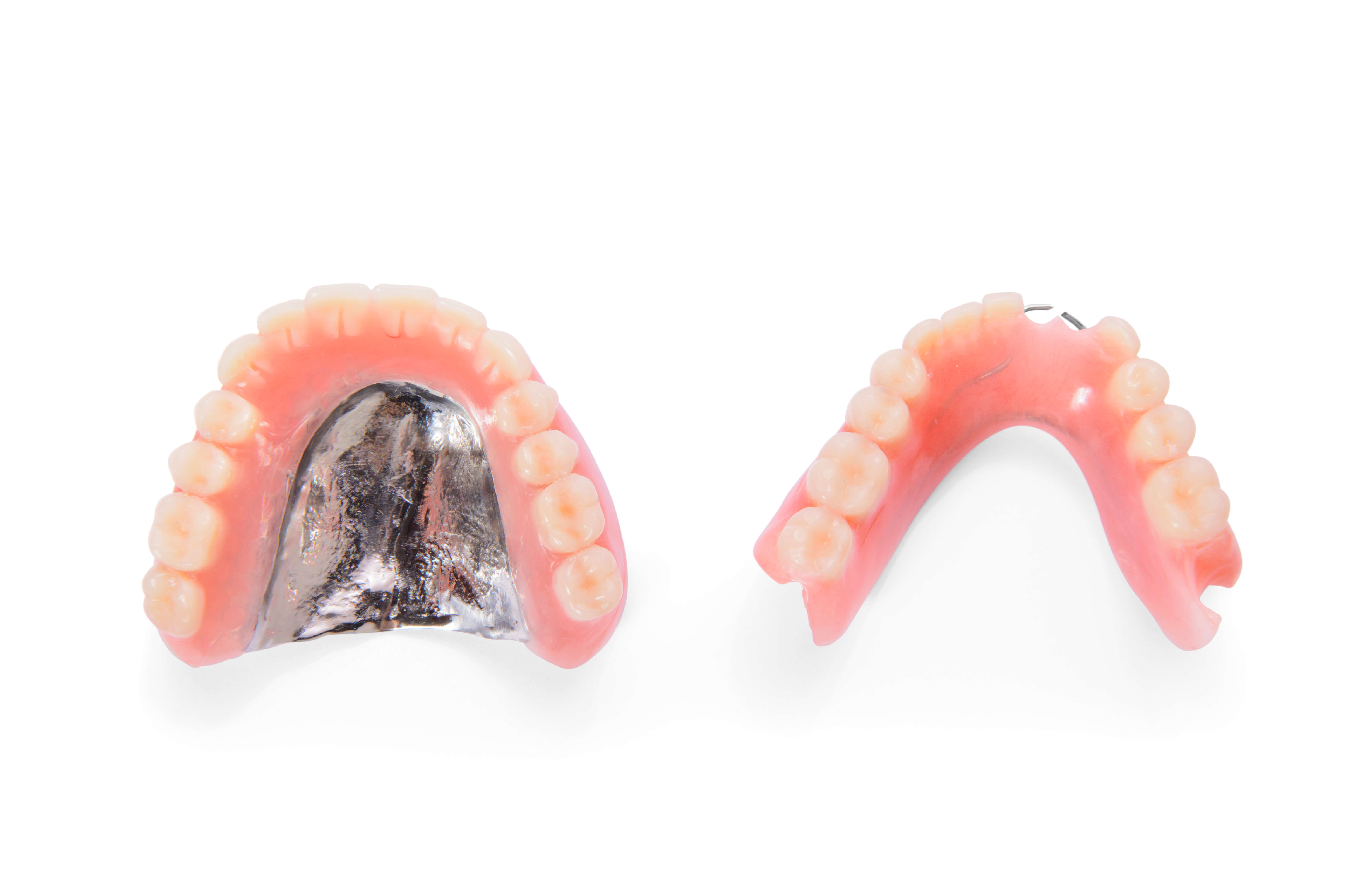 金属のフレームと強化プラスチック・セラミックの歯